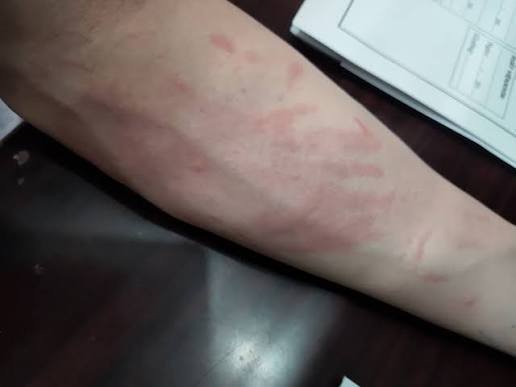 Germostop – Përbërja, Përdorimi, Çmimi dhe Efektet Anësore